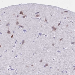 TMEM35 Antibody, Novus Biologicals:Antibodies:Primary Antibodies