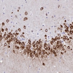 TMEM35 Antibody, Novus Biologicals:Antibodies:Primary Antibodies