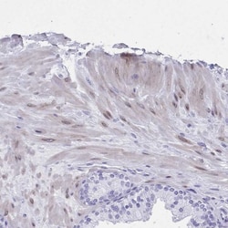 TMEM35 Antibody, Novus Biologicals:Antibodies:Primary Antibodies