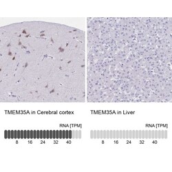 TMEM35 Antibody, Novus Biologicals:Antibodies:Primary Antibodies