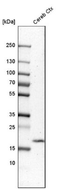 TMEM35 Antibody, Novus Biologicals:Antibodies:Primary Antibodies