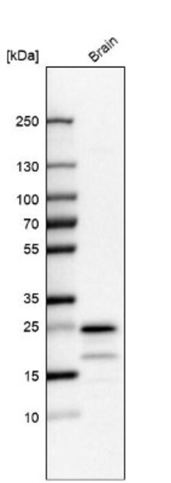TMEM35 Antibody, Novus Biologicals:Antibodies:Primary Antibodies