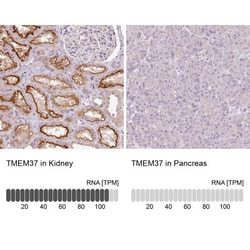TMEM37 Antibody, Novus Biologicals:Antibodies:Primary Antibodies