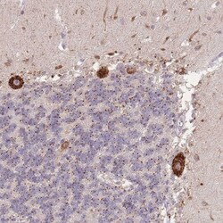 TMEM38A Antibody, Novus Biologicals 0.1mL; Unlabeled:Antibodies, Polyclonal