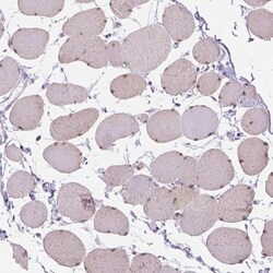 TMEM38A Antibody, Novus Biologicals 0.1mL; Unlabeled:Antibodies, Polyclonal