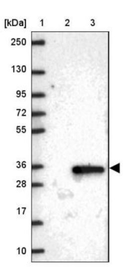 TMEM38A Antibody, Novus Biologicals 0.1mL; Unlabeled:Antibodies, Polyclonal