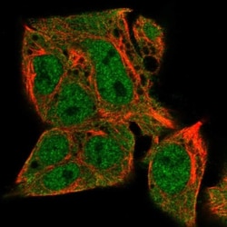 TMEM41A Antibody, Novus Biologicals 0.1mL; Unlabeled:Antibodies, Polyclonal