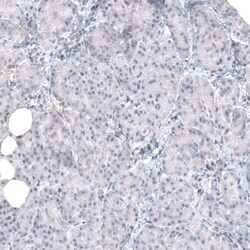 TMEM43 Antibody, Novus Biologicals:Antibodies:Primary Antibodies