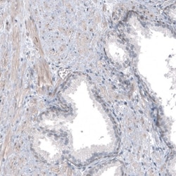 TMEM43 Antibody, Novus Biologicals:Antibodies:Primary Antibodies