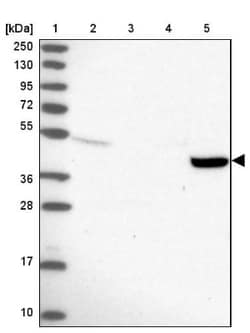 TMEM44 Antibody, Novus Biologicals 25 &mu;L | Buy Online | Novus Biologicals | Fisher Scientific