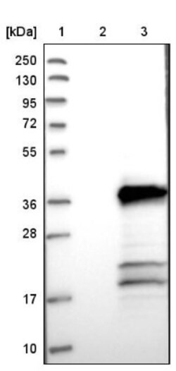 TMEM53 Antibody, Novus Biologicals:Antibodies:Primary Antibodies