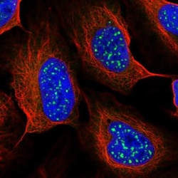 TMEM56 Antibody, Novus Biologicals 25 &mu;L, Unlabeled:Antibodies, Polyclonal