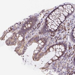 TMEM71 Antibody, Novus Biologicals:Antibodies:Primary Antibodies