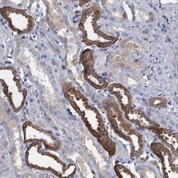 TMEM72 Antibody, Novus Biologicals 0.1mL; Unlabeled:Antibodies, Polyclonal