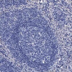 TMEM72 Antibody, Novus Biologicals 0.1mL; Unlabeled:Antibodies, Polyclonal