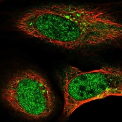 TMEM74B Antibody, Novus Biologicals 0.1mL; Unlabeled:Antibodies, Polyclonal