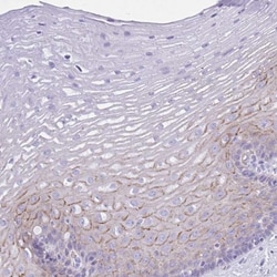 TMEM79 Antibody, Novus Biologicals 0.1 mL | Buy Online | Novus Biologicals | Fisher Scientific