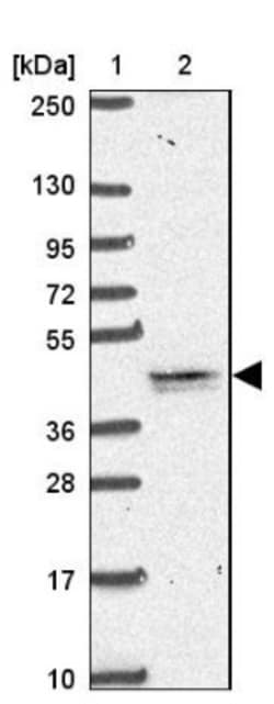 TMEM79 Antibody, Novus Biologicals 0.1 mL | Buy Online | Novus Biologicals | Fisher Scientific