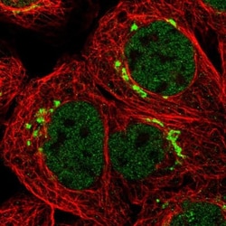 TMEM87A Antibody, Novus Biologicals 0.1mL; Unlabeled:Antibodies, Polyclonal