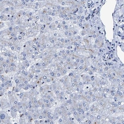 TMEM87A Antibody, Novus Biologicals 0.1mL; Unlabeled:Antibodies, Polyclonal