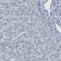 TMEM87A Antibody, Novus Biologicals 25 &mu;L; Unlabeled:Antibodies, Polyclonal