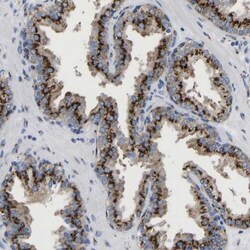TMEM87A Antibody, Novus Biologicals 25 &mu;L; Unlabeled:Antibodies, Polyclonal