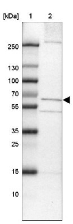 TMEM87A Antibody, Novus Biologicals 25 &mu;L; Unlabeled:Antibodies, Polyclonal