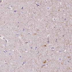 TMEM88B Antibody, Novus Biologicals 25 &mu;L, Unlabeled:Antibodies, Polyclonal