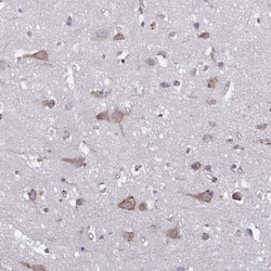 TMEM8C Antibody, Novus Biologicals 0.1mL; Unlabeled:Antibodies, Polyclonal