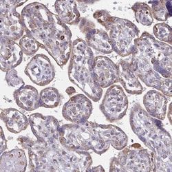TMEM8C Antibody, Novus Biologicals 0.1mL; Unlabeled:Antibodies, Polyclonal