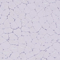 TMEM8C Antibody, Novus Biologicals 0.1mL; Unlabeled:Antibodies, Polyclonal