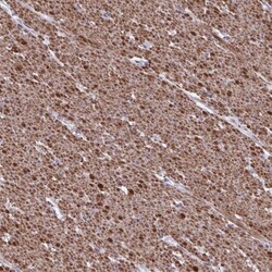 TMEM92 Antibody, Novus Biologicals:Antibodies:Primary Antibodies