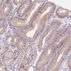 TMEM93 Antibody, Novus Biologicals 0.1mL; Unlabeled:Antibodies, Polyclonal