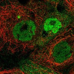 TMEM98 Antibody, Novus Biologicals:Antibodies:Primary Antibodies