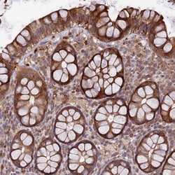 TMEM98 Antibody, Novus Biologicals:Antibodies:Primary Antibodies