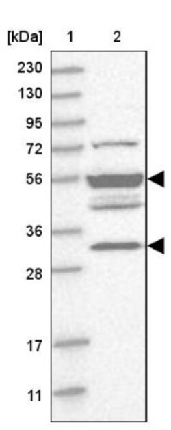 TMPPE Antibody, Novus Biologicals:Antibodies:Primary Antibodies