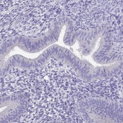 TMPRSS2 Antibody, Novus Biologicals 0.1mL; Unlabeled:Antibodies, Polyclonal
