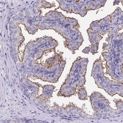 TMPRSS2 Antibody, Novus Biologicals 0.1mL; Unlabeled:Antibodies, Polyclonal