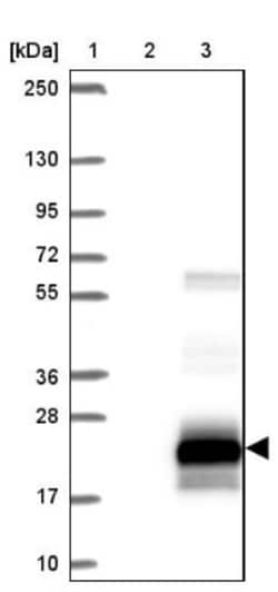 TMPRSS2 Antibody, Novus Biologicals 0.1mL; Unlabeled:Antibodies, Polyclonal