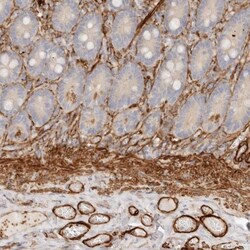 TMTC2 Antibody, Novus Biologicals 25 &mu;L; Unlabeled:Antibodies, Polyclonal