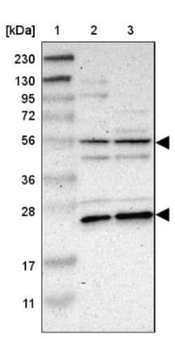 TNF RI/TNFRSF1A Antibody, Novus Biologicals 25 &mu;L; Unlabeled:Antibodies,