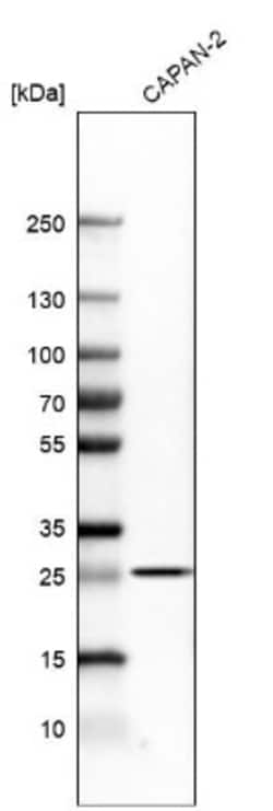 TNF RI/TNFRSF1A Antibody, Novus Biologicals 25 &mu;L; Unlabeled:Antibodies,