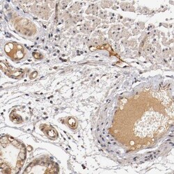 anti-TNF RII/TNFRSF1B, Polyclonal, Novus Biologicals 0.1mL; Unlabeled:Antibodies,