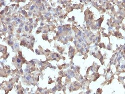 TNF-alpha Antibody (TNFA/1172), Novus Biologicals 0.2mg; Unlabeled:Antibodies,