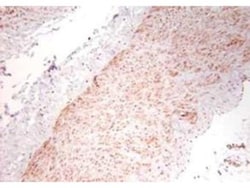TNF-alpha Antibody - Azide Free, Novus Biologicals:Antibodies:Primary Antibodies