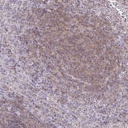 TNFAIP8 Antibody, Novus Biologicals 25 &mu;L, Unlabeled:Antibodies, Polyclonal