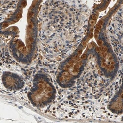 TNIK Antibody, Novus Biologicals 25 &mu;L; Unlabeled:Antibodies, Polyclonal