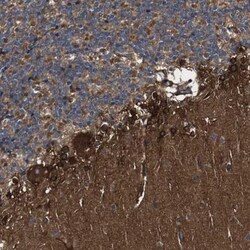 TNIK Antibody, Novus Biologicals 0.1mL; Unlabeled:Antibodies, Polyclonal