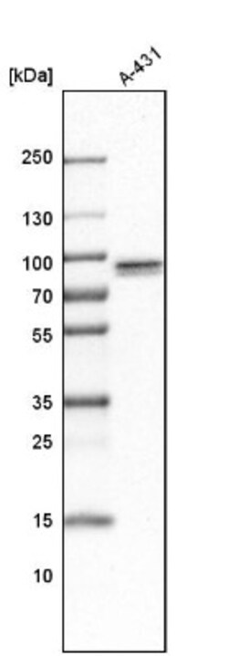 TNIP1 Antibody, Novus Biologicals 25 &mu;L | Buy Online | Novus Biologicals | Fisher Scientific