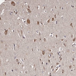 TNRC4 Antibody, Novus Biologicals 25 &mu;L; Unlabeled:Antibodies, Polyclonal